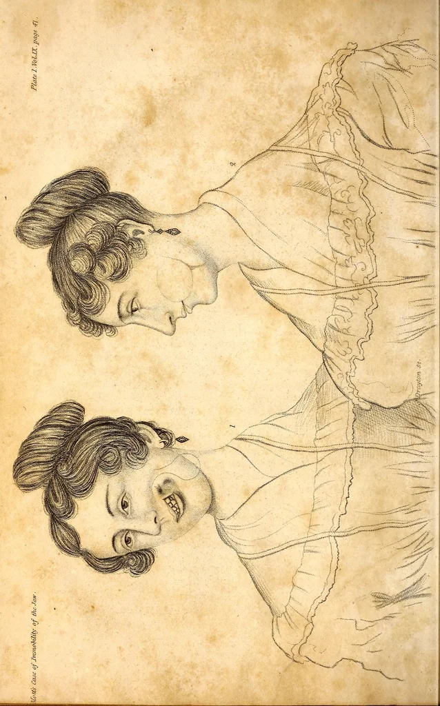 An illustration from The American journal of the medical sciences, 1827, leaf 22