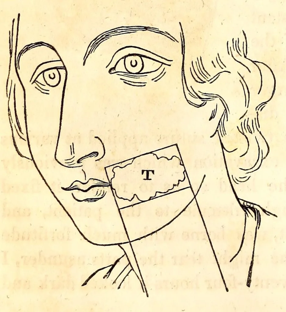 An illustration from The American journal of the medical sciences, 1827, leaf 342