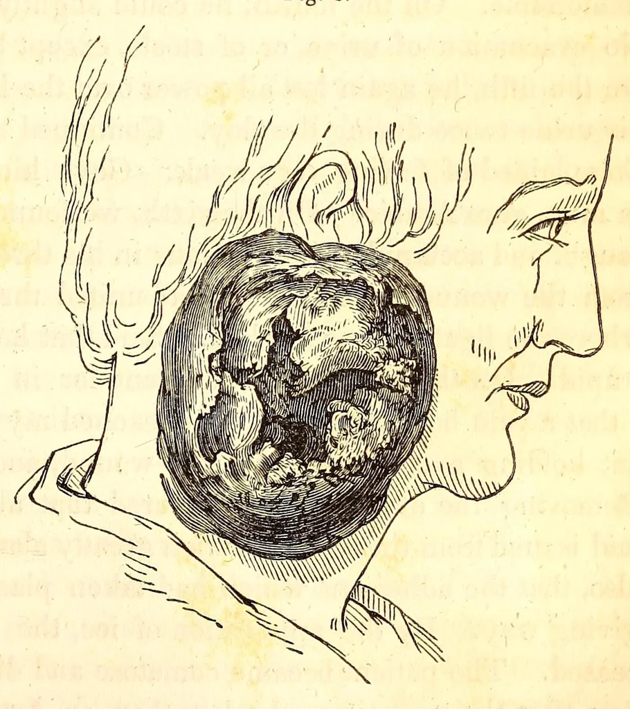 An illustration from The American journal of the medical sciences, 1827, leaf 343