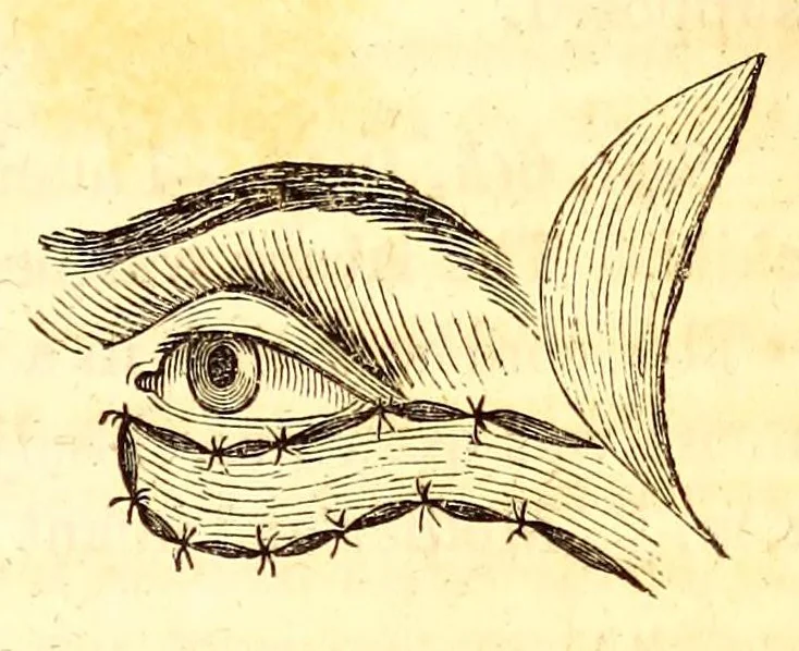 An illustration from The American journal of the medical sciences, 1827, leaf 369