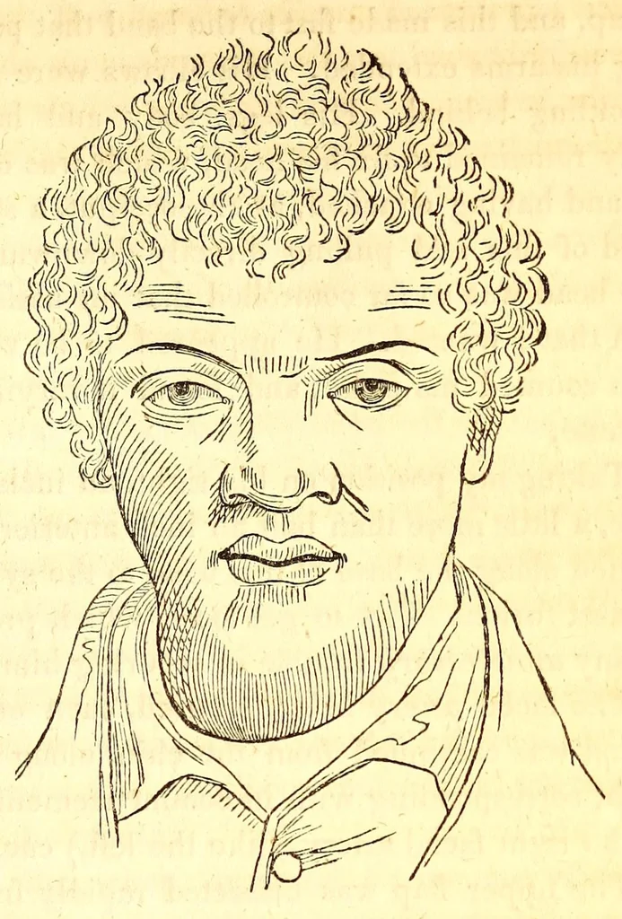 An illustration from The American journal of the medical sciences, 1827, leaf 135