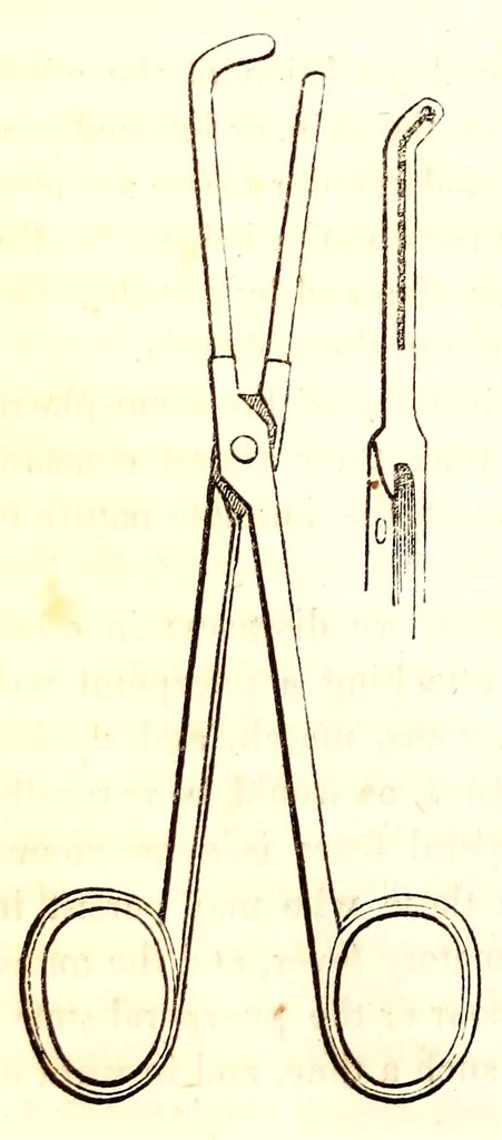An illustration from The American journal of the medical sciences, 1827, leaf 354