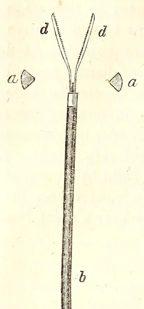 An illustration from The American journal of the medical sciences, 1827, leaf 118