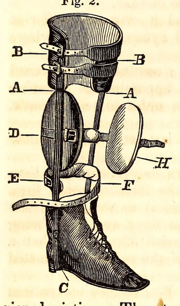 An illustration from The American journal of the medical sciences, 1827, leaf 106