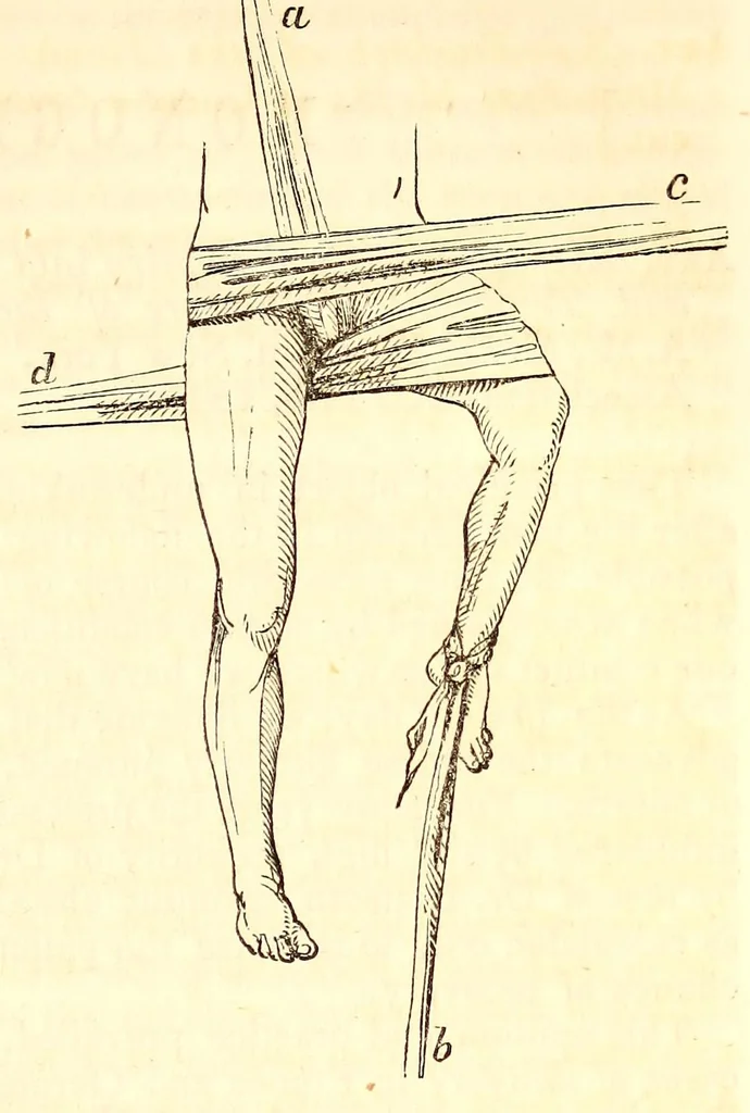 An illustration from The American journal of the medical sciences, 1827, leaf 117