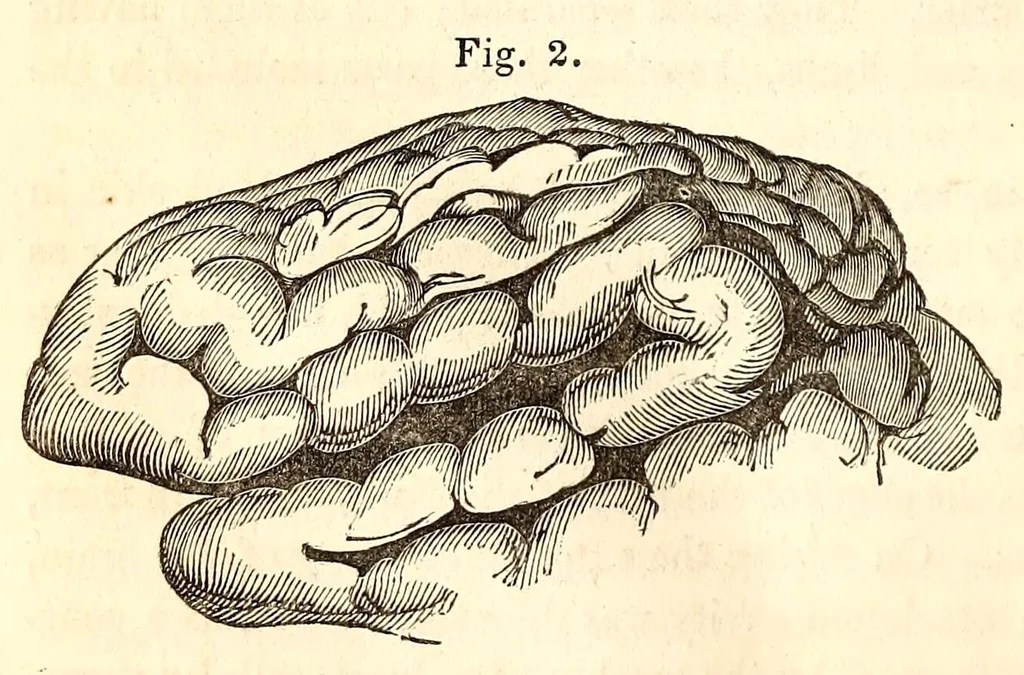 An illustration from The American journal of the medical sciences, 1827, leaf 354