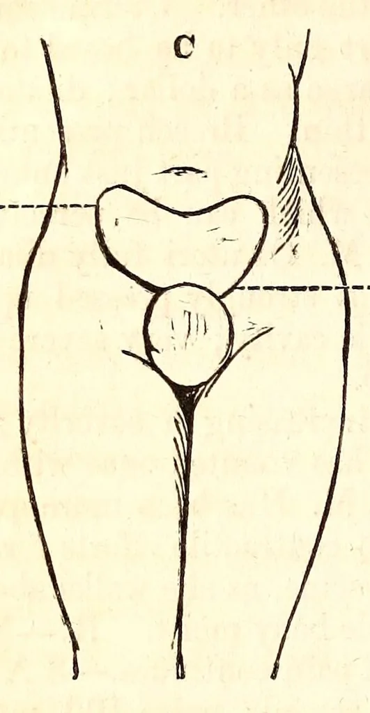 An illustration from The American journal of the medical sciences, 1827, leaf 366