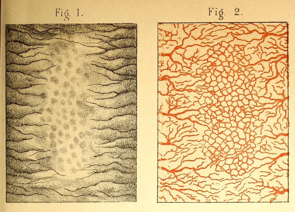 An illustration from The American journal of the medical sciences, 1827, leaf 553