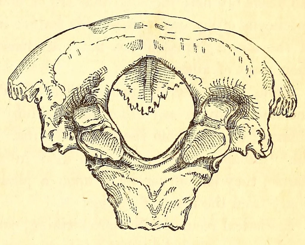An illustration from The American journal of the medical sciences, 1827, leaf 87