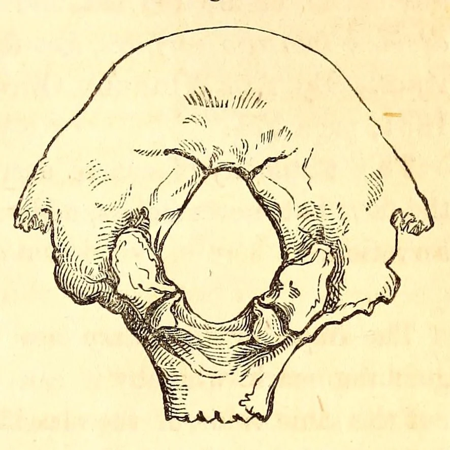 An illustration from The American journal of the medical sciences, 1827, leaf 89