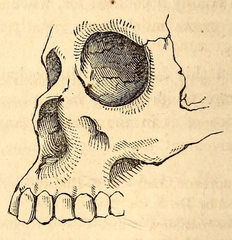 An illustration from The American journal of the medical sciences, 1827, leaf 90