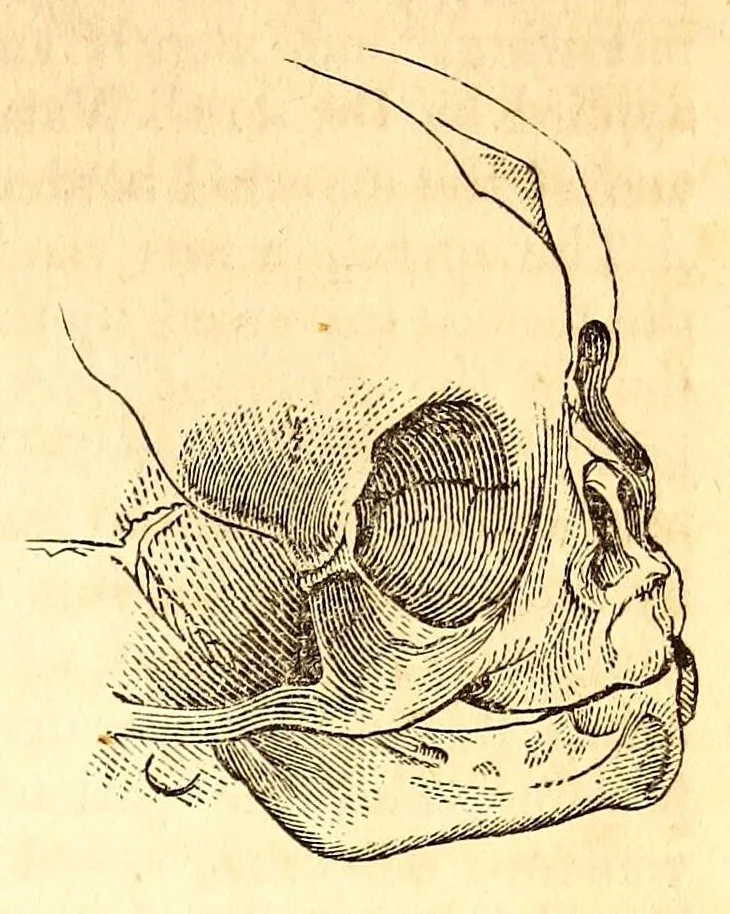 An illustration from The American journal of the medical sciences, 1827, leaf 91