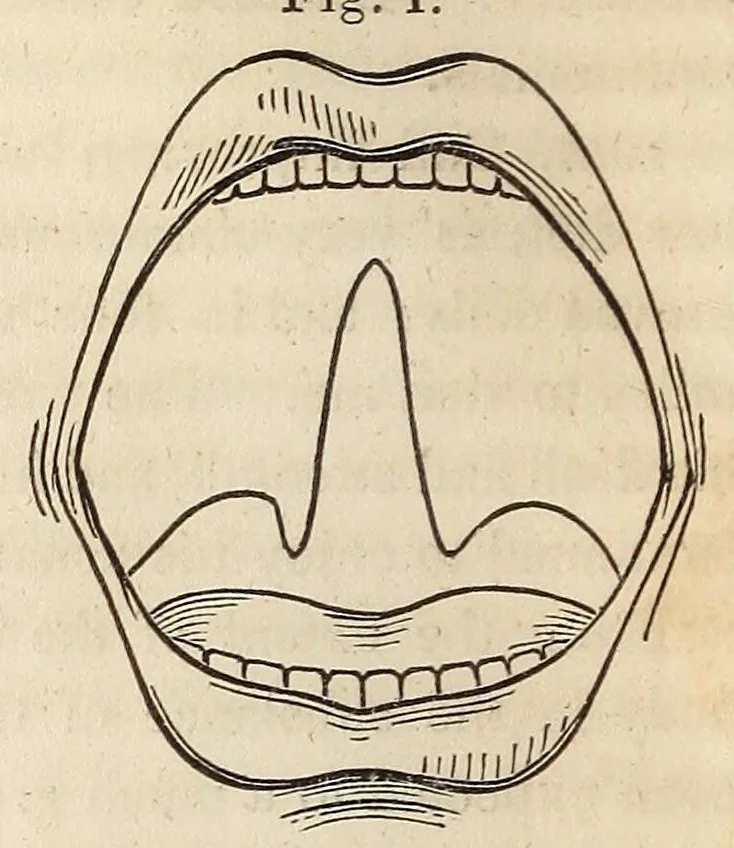 An illustration from The American journal of the medical sciences, 1827, leaf 78
