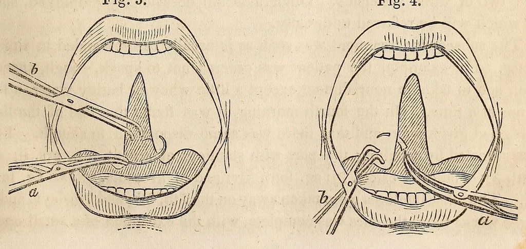 An illustration from The American journal of the medical sciences, 1827, leaf 79