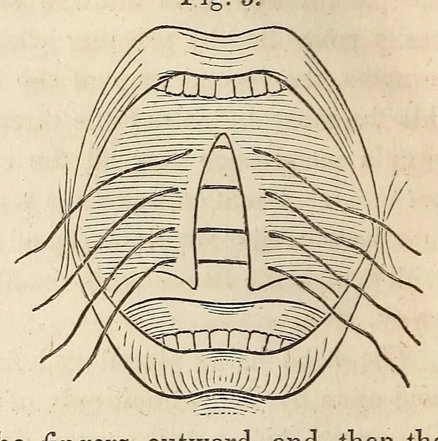 An illustration from The American journal of the medical sciences, 1827, leaf 80