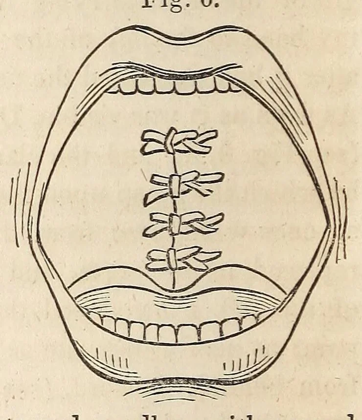 An illustration from The American journal of the medical sciences, 1827, leaf 80