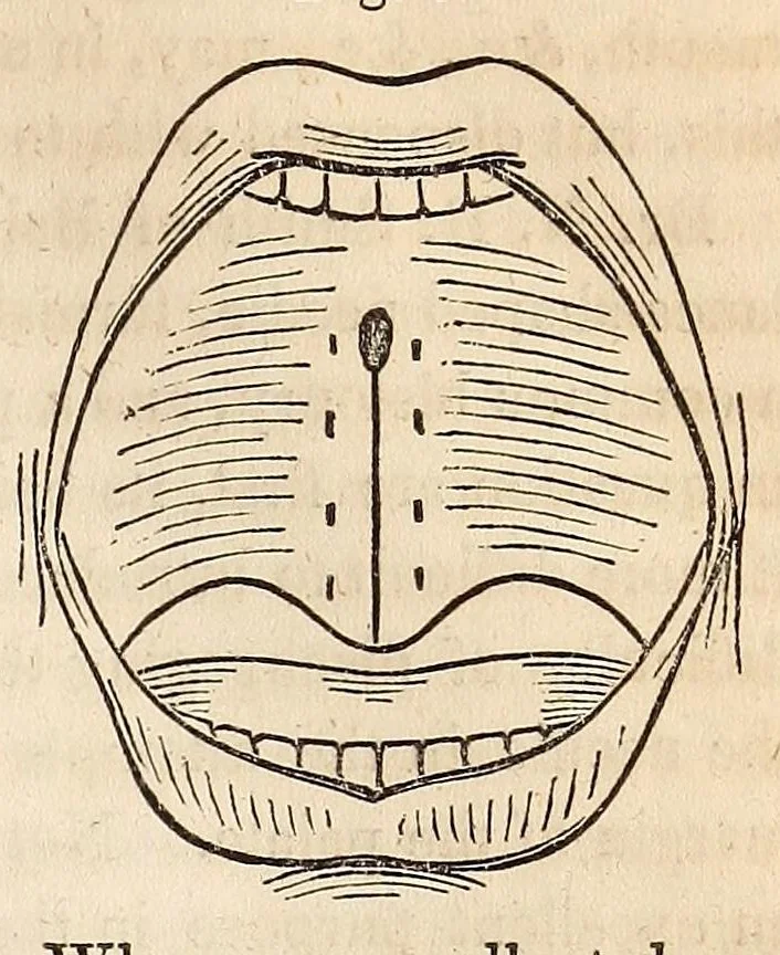 An illustration from The American journal of the medical sciences, 1827, leaf 81