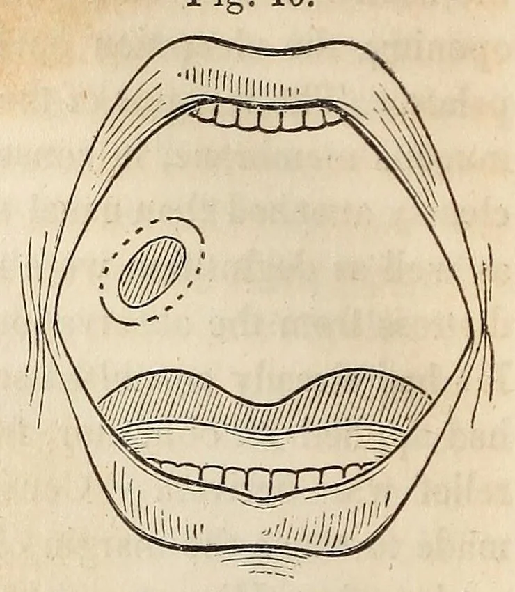 An illustration from The American journal of the medical sciences, 1827, leaf 90