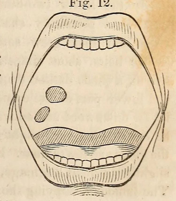 An illustration from The American journal of the medical sciences, 1827, leaf 91