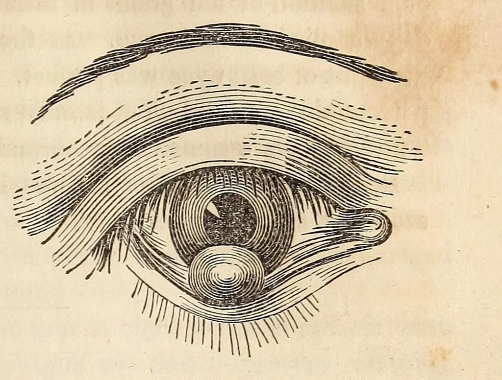 An illustration from The American journal of the medical sciences, 1827, leaf 93