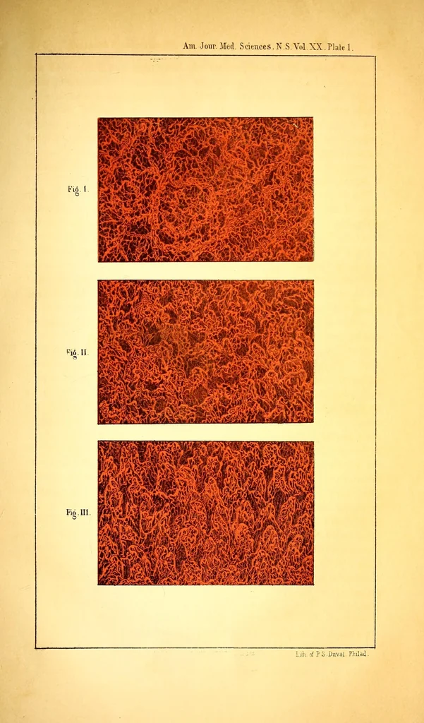 An illustration from The American journal of the medical sciences, 1827, leaf 29