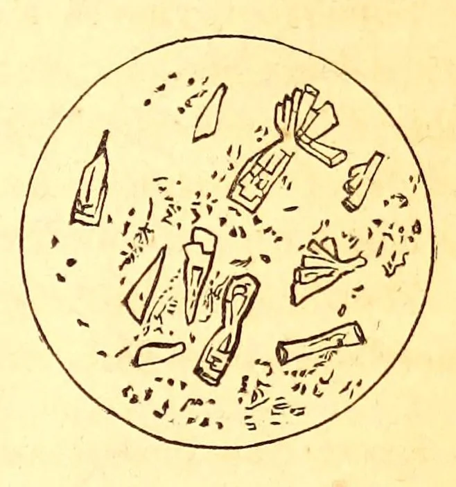 An illustration from The American journal of the medical sciences, 1827, leaf 383