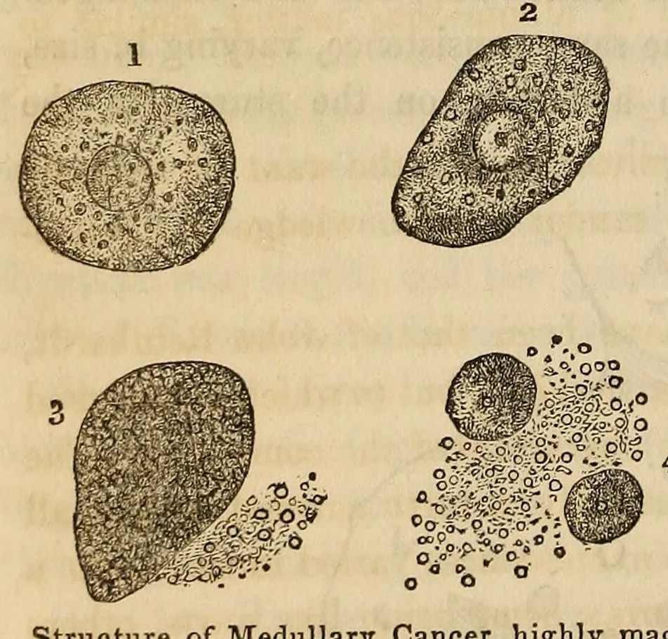 An illustration from The American journal of the medical sciences, 1827, leaf 406