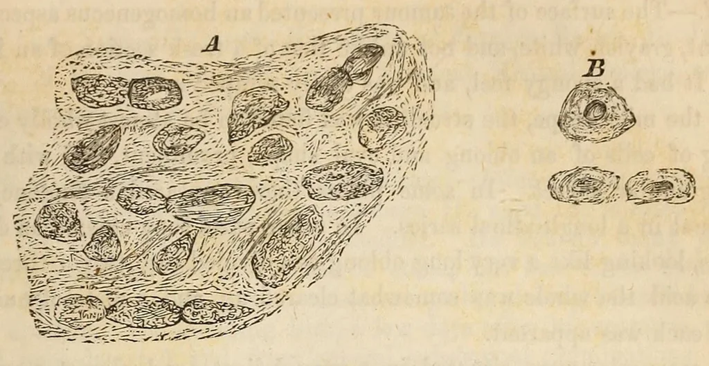 An illustration from The American journal of the medical sciences, 1827, leaf 425