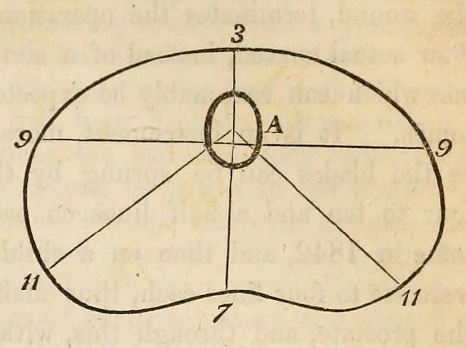 An illustration from The American journal of the medical sciences, 1827, leaf 429