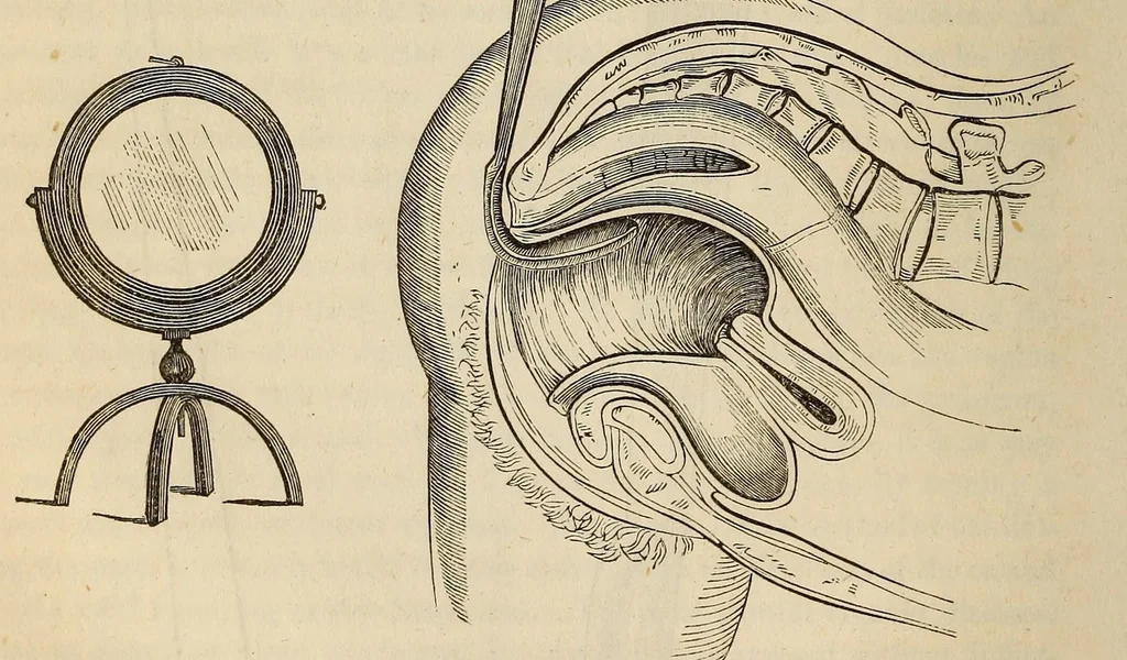 An illustration from The American journal of the medical sciences, 1827, leaf 86