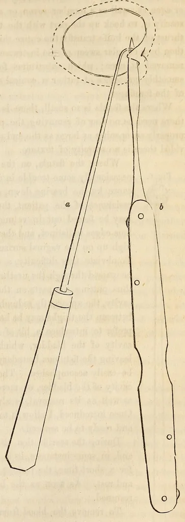 An illustration from The American journal of the medical sciences, 1827, leaf 87
