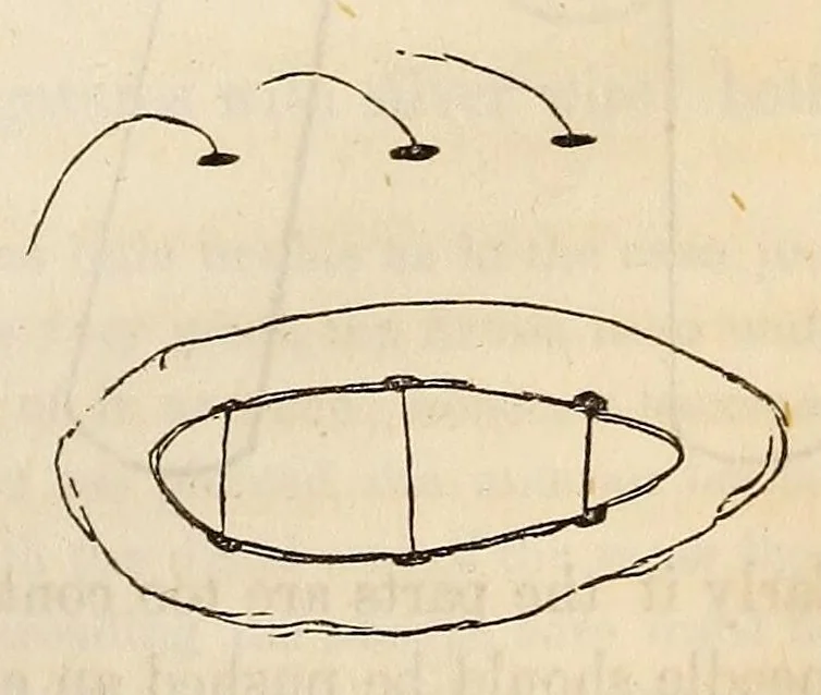 An illustration from The American journal of the medical sciences, 1827, leaf 91