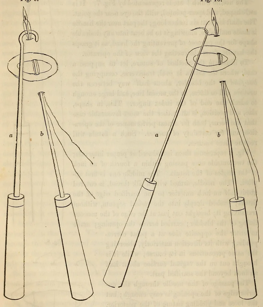 An illustration from The American journal of the medical sciences, 1827, leaf 92