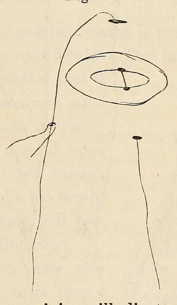 An illustration from The American journal of the medical sciences, 1827, leaf 93