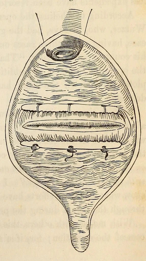An illustration from The American journal of the medical sciences, 1827, leaf 95