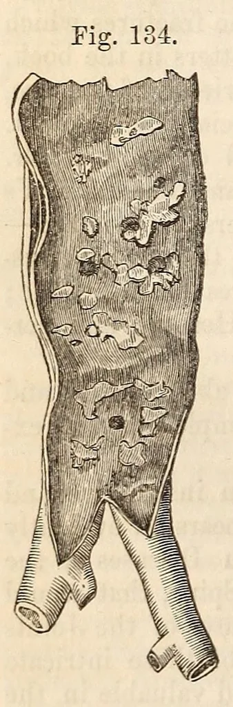 An illustration from The American journal of the medical sciences, 1827, leaf 458