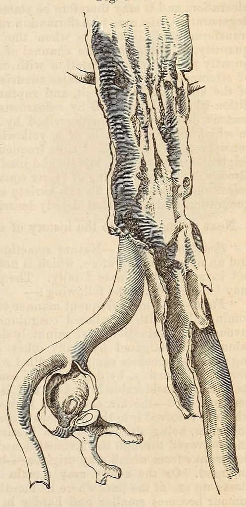 An illustration from The American journal of the medical sciences, 1827, leaf 459