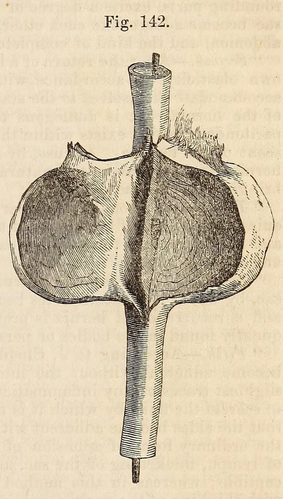 An illustration from The American journal of the medical sciences, 1827, leaf 461