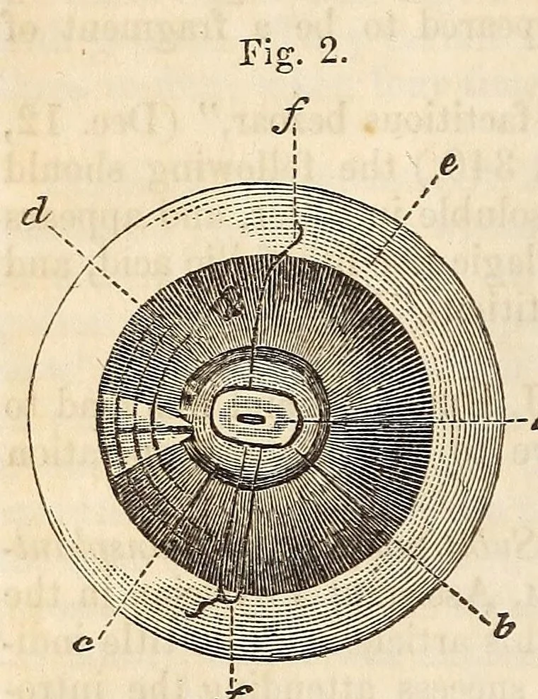 An illustration from The American journal of the medical sciences, 1827, leaf 104