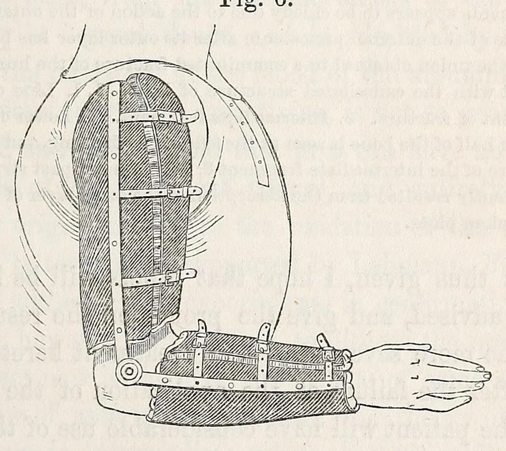 An illustration from The American journal of the medical sciences, 1827, leaf 127