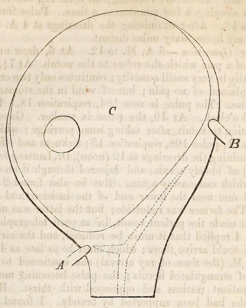 An illustration from The American journal of the medical sciences, 1827, leaf 415