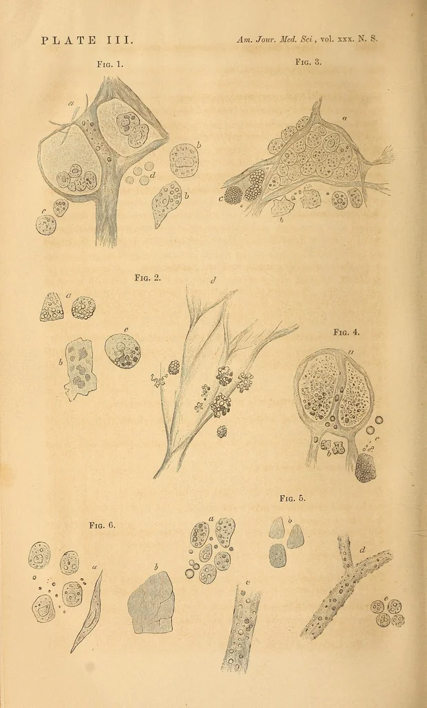 An illustration from The American journal of the medical sciences, 1827, leaf 326