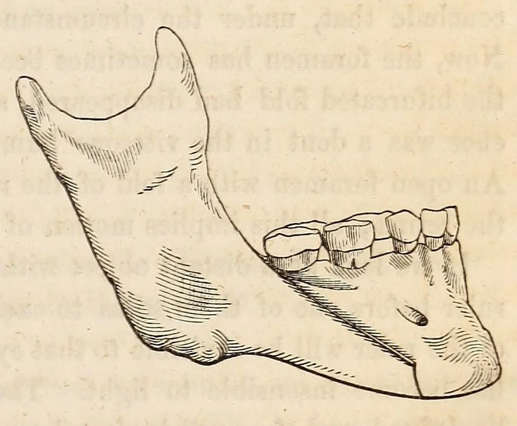 An illustration from The American journal of the medical sciences, 1827, leaf 89