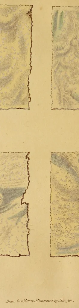 An illustration from The American journal of the medical sciences, 1827, leaf 286