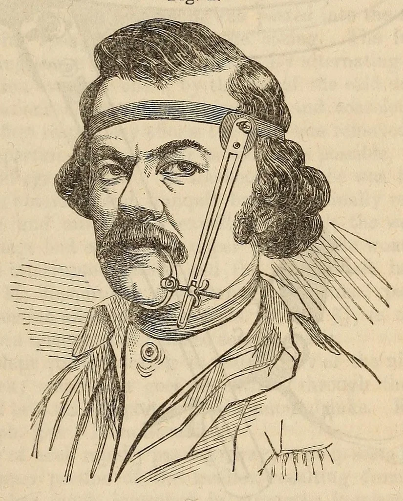 An illustration from The American journal of the medical sciences, 1827, leaf 25