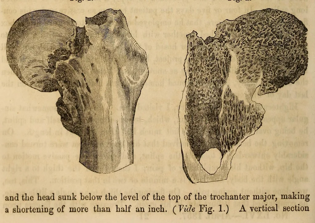 An illustration from The American journal of the medical sciences, 1827, leaf 312