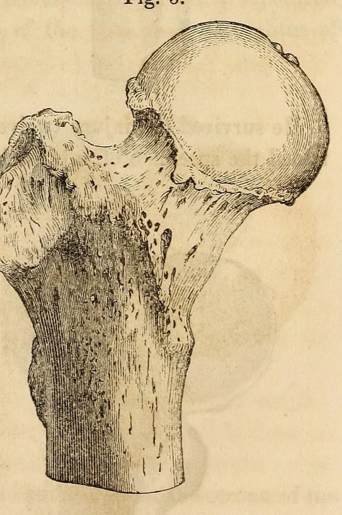 An illustration from The American journal of the medical sciences, 1827, leaf 313