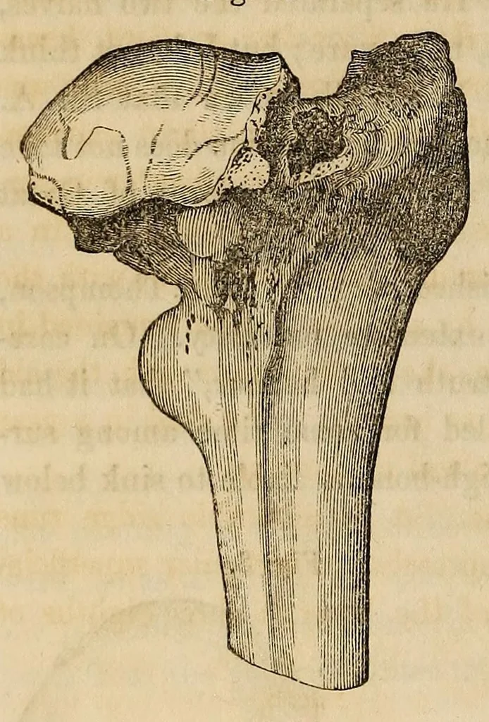 An illustration from The American journal of the medical sciences, 1827, leaf 314
