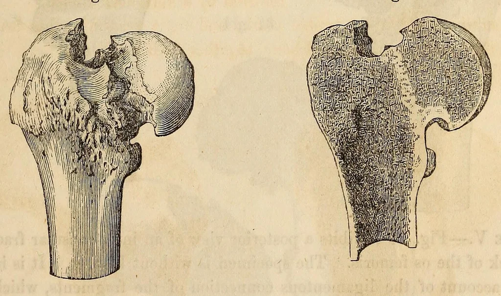 An illustration from The American journal of the medical sciences, 1827, leaf 315