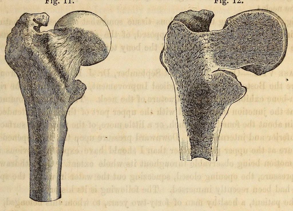 An illustration from The American journal of the medical sciences, 1827, leaf 317